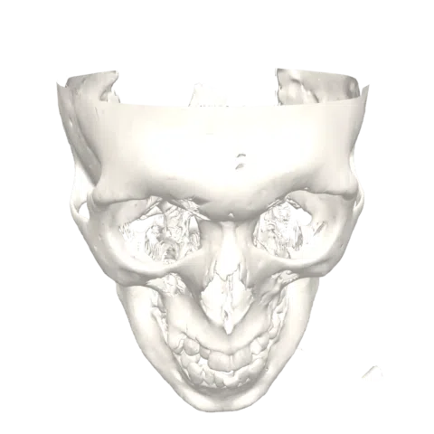 Modèle 3D du crâne — rotation 360°
